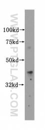 15661-1-AP - Islet-1 / ISL1