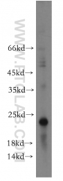 12300-1-AP - ITGB1BP1 / ICAP1