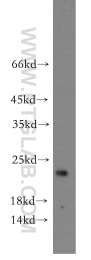 12300-1-AP - ITGB1BP1 / ICAP1