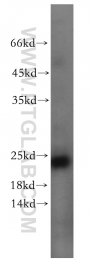12300-1-AP - ITGB1BP1 / ICAP1