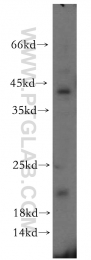 12300-1-AP - ITGB1BP1 / ICAP1