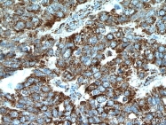 21703-1-AP - Integrin beta-6 / ITGB6