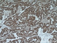 21703-1-AP - Integrin beta-6 / ITGB6