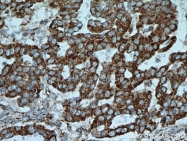 21703-1-AP - Integrin beta-6 / ITGB6