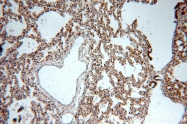 19695-1-AP - Integrin beta-6 / ITGB6