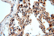 19695-1-AP - Integrin beta-6 / ITGB6