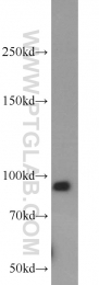 19695-1-AP - Integrin beta-6 / ITGB6