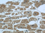 11770-1-AP - Intelectin-1 / Omentin