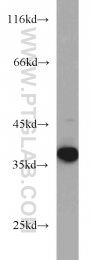 11770-1-AP - Intelectin-1 / Omentin