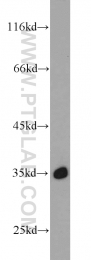 11770-1-AP - Intelectin-1 / Omentin