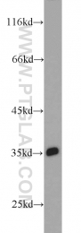 11770-1-AP - Intelectin-1 / Omentin