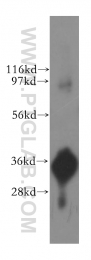 11770-1-AP - Intelectin-1 / Omentin