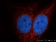 14270-1-AP - ITPKA / IP3 3-kinase A