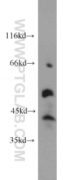 14270-1-AP - ITPKA / IP3 3-kinase A