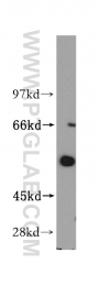 14270-1-AP - ITPKA / IP3 3-kinase A
