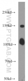 12816-1-AP - IP3 3-kinase B / ITPKB