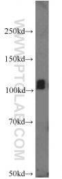 12816-1-AP - IP3 3-kinase B / ITPKB