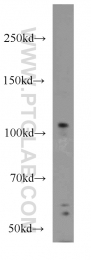 12816-1-AP - IP3 3-kinase B / ITPKB