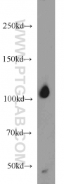 12816-1-AP - IP3 3-kinase B / ITPKB