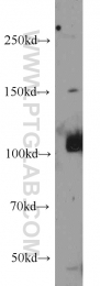 12816-1-AP - IP3 3-kinase B / ITPKB