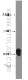 12816-1-AP - IP3 3-kinase B / ITPKB