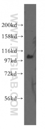 12816-1-AP - IP3 3-kinase B / ITPKB