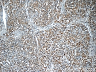 14267-1-AP - IP3 3-kinase C / ITPKC
