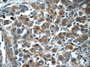 14267-1-AP - IP3 3-kinase C / ITPKC
