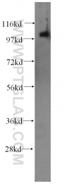 14267-1-AP - IP3 3-kinase C / ITPKC