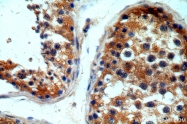 19962-1-AP - IP3 receptor 1 / ITPR1