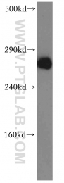 19962-1-AP - IP3 receptor 1 / ITPR1