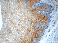 55328-1-AP - Involucrin / IVL