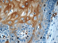 55328-1-AP - Involucrin / IVL