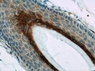 55328-1-AP - Involucrin / IVL