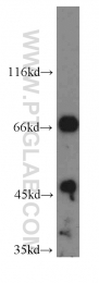 14741-1-AP - IVNS1ABP