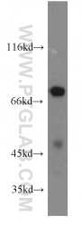 14741-1-AP - IVNS1ABP