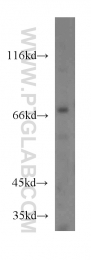 14741-1-AP - IVNS1ABP