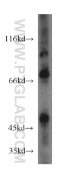 14741-1-AP - IVNS1ABP