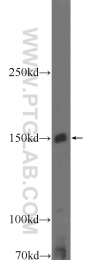 17670-1-AP - Tyrosine-protein kinase JAK2