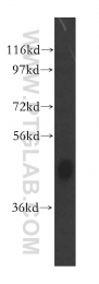 16476-1-AP - JMJD6 / PTDSR