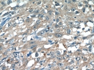 24164-1-AP - MAPK8 / JNK1