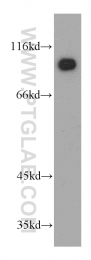 21733-1-AP - KANK2 / SIP