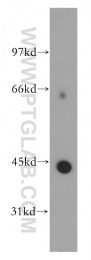 12657-1-AP - KCNJ13