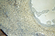 12835-1-AP - KDM3A / JHDM2A