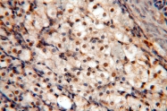 12835-1-AP - KDM3A / JHDM2A