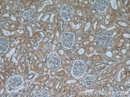 12835-1-AP - KDM3A / JHDM2A