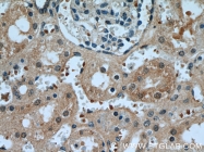 12835-1-AP - KDM3A / JHDM2A