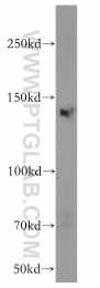 12835-1-AP - KDM3A / JHDM2A