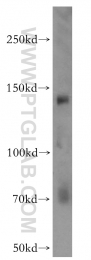12835-1-AP - KDM3A / JHDM2A