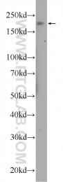 19915-1-AP - JMJD1B / KDM3B